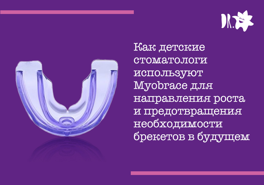 Как детские стоматологи используют Myobrace для направления роста и предотвращения необходимости брекетов в будущем